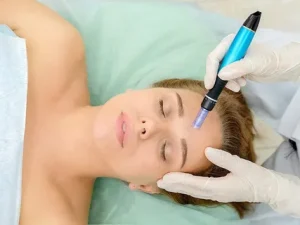 Dermapen Kalıcı mı