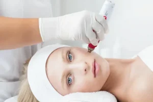 Dermapen Nasıl Yapılır 