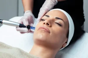 Dermapen Sonrası Yüz Ne Zaman Yıkanır